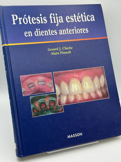 Protesis Fija Estetica En Dientes Anteriores de Gerard J. Chiche | Libro segunda mano - Portada