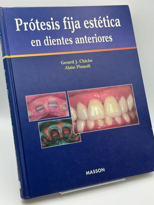 Protesis Fija Estetica En Dientes Anteriores de Gerard J. Chiche | Libro segunda mano - Portada